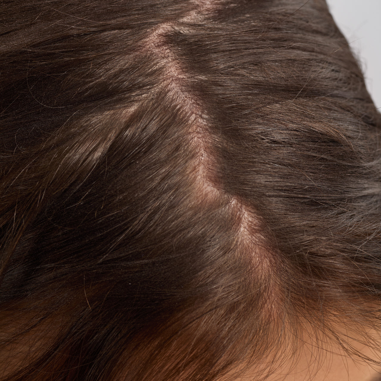 Óleo de Alecrim para Fortalecimento do Couro Cabeludo e do Cabelo com Biotina 3 Embalagens